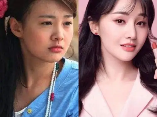 郑爽整容,从邻家小妹到大气女神的蜕变9696娱乐圈整容_圈子-新氧