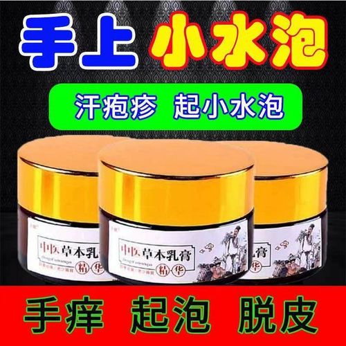 汗疱疹油鹅掌风止痒膏手上长水泡牛皮癣皮炎湿疹皮肤过敏瘙痒脱皮
