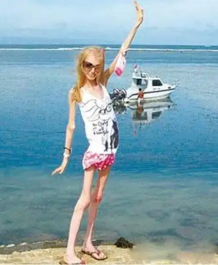 世界上最瘦的女人是谁kseniyabubenko皮包骨头的图片