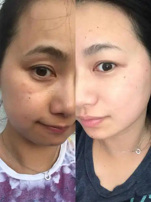 美白界模范生来了!淡斑亮白效果看得见