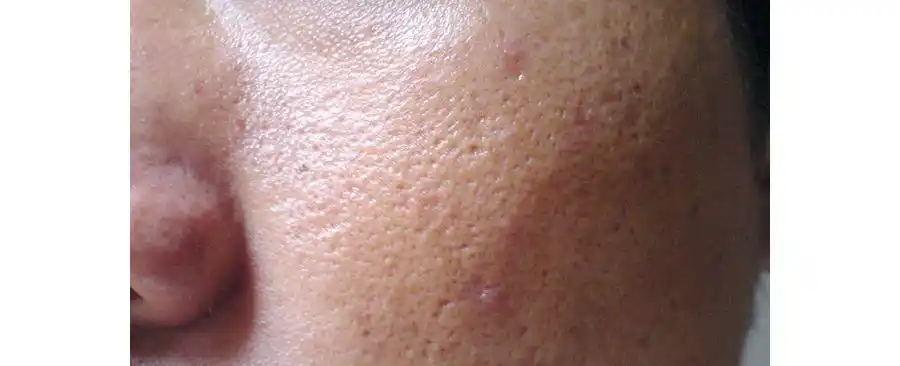 为什么别人的妆那么服帖,你的毛孔粗大怎么办?