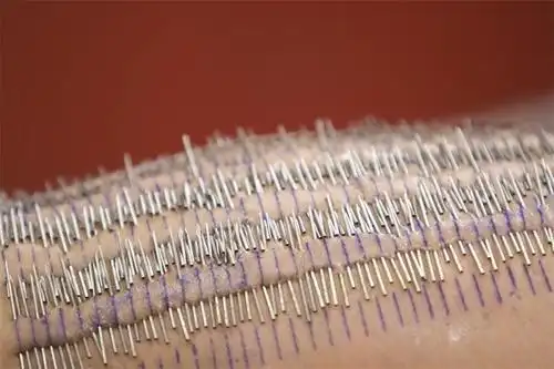 令人惊叹!美国杂耍女演员裸身穿刺3200根针(组图)