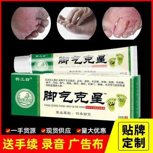 脚气克星乳膏止痒膏草本抑菌狼毒脚气膏脚痒脚臭烂脚丫跑江湖地摊