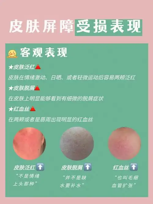 赶紧自查皮肤有这些症状说明你皮肤屏障受损了