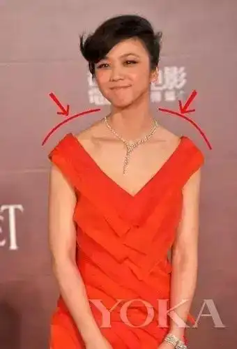 斜方肌影响美观,千方百计把它减掉,才是王道!-搜狐