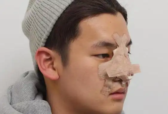 驼峰鼻的男人的命运 生性冷漠意志力强个性偏执容易失败