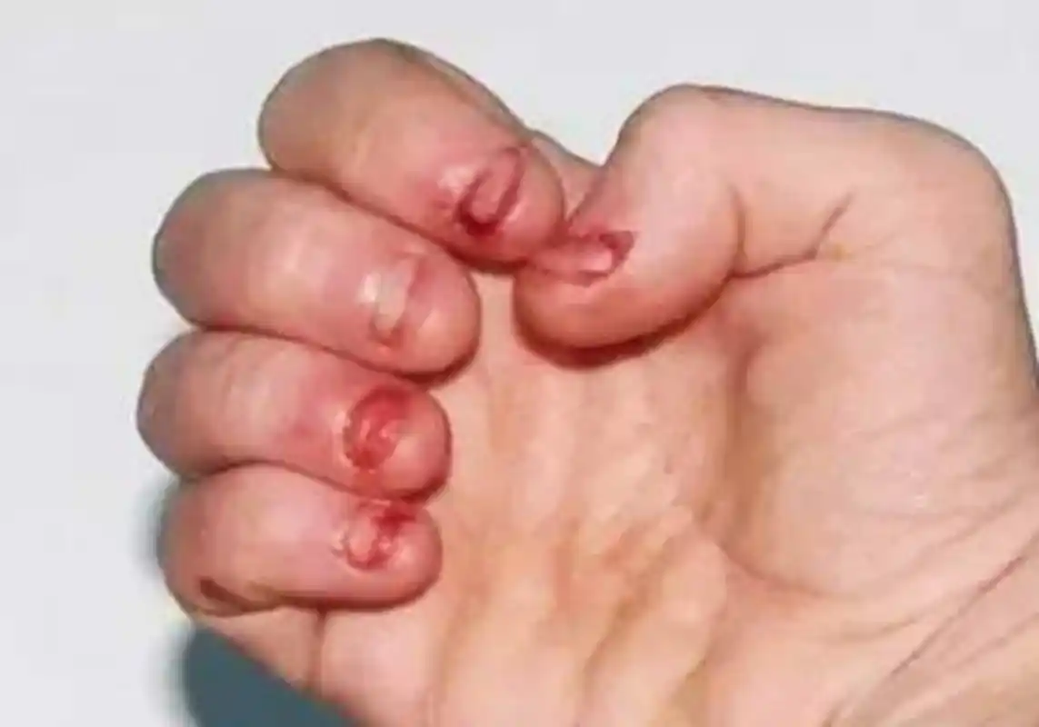 原创经常咬指甲的孩子长大后是什么样三种结局很残酷趁早改