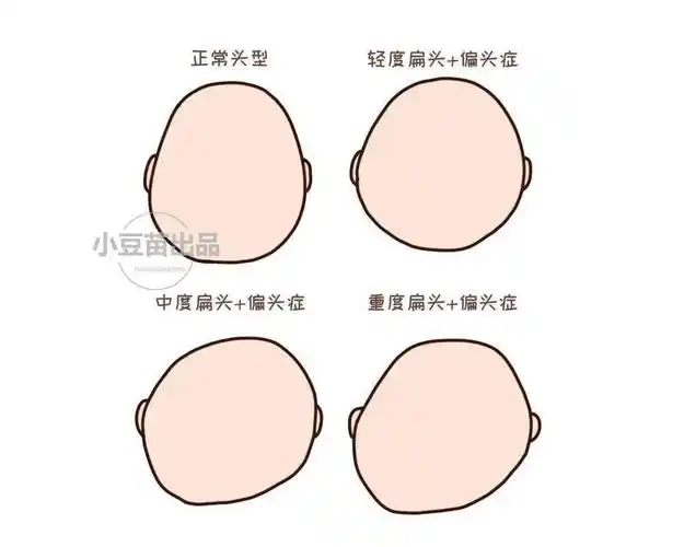 头大的宝宝更聪明真的吗