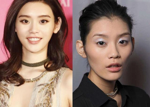 通过对比图,我们不难看出奚梦瑶是做了面部填充的.
