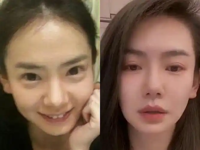 拥有一双美丽眼睛的重要性.盘点割过双眼皮的明星