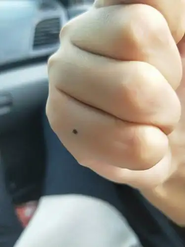 女 右手小拇指上有课痣 是好是坏?