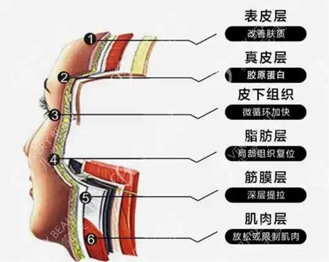 做pst面部提升术需要多少钱?