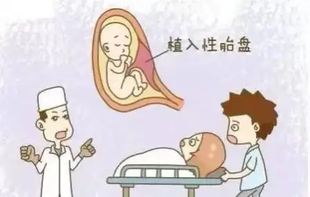 胎盘植入是胎盘绒毛不同程度的侵入子宫肌层,甚至突破浆膜层.