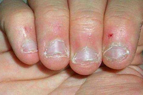 没那么简单,这4个因素才是关键_手指