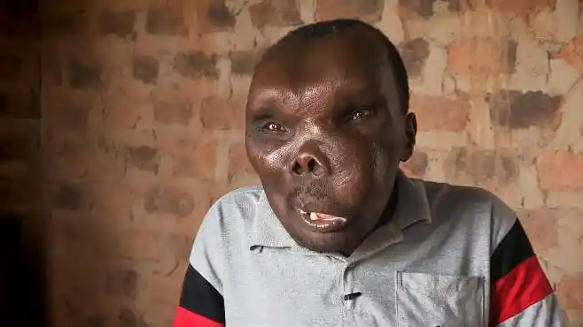 男子长相奇丑无比,谁知因祸得福,娶漂亮老婆生8个孩子