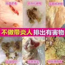 00 妇科炎症凝胶私处抑菌止痒宫颈糜烂重度霉菌性阴炎瘙痒白带去异味