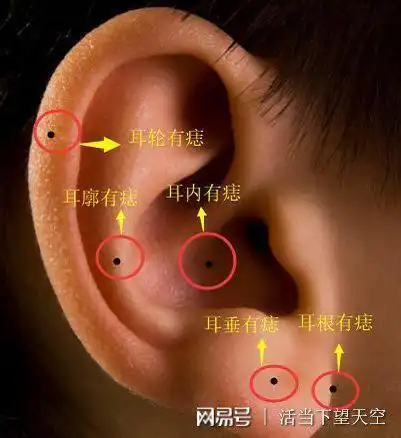 耳朵上有痣到底是吉还是凶呢