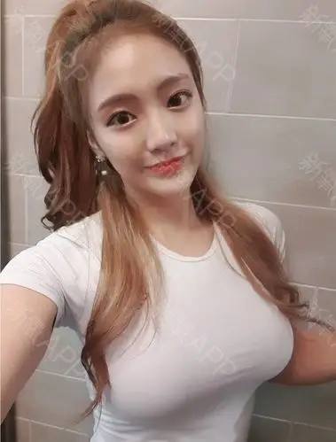 广州假体隆胸好不好_效果图_氧气fwm7c27假体隆胸术后第107天_新氧