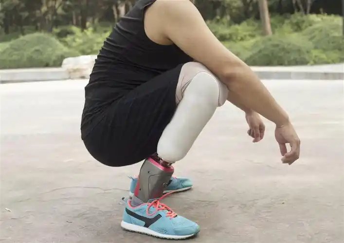 智能动力小腿假肢 - 有爱的世界 无碍的生活 —2018深圳市辅助器具