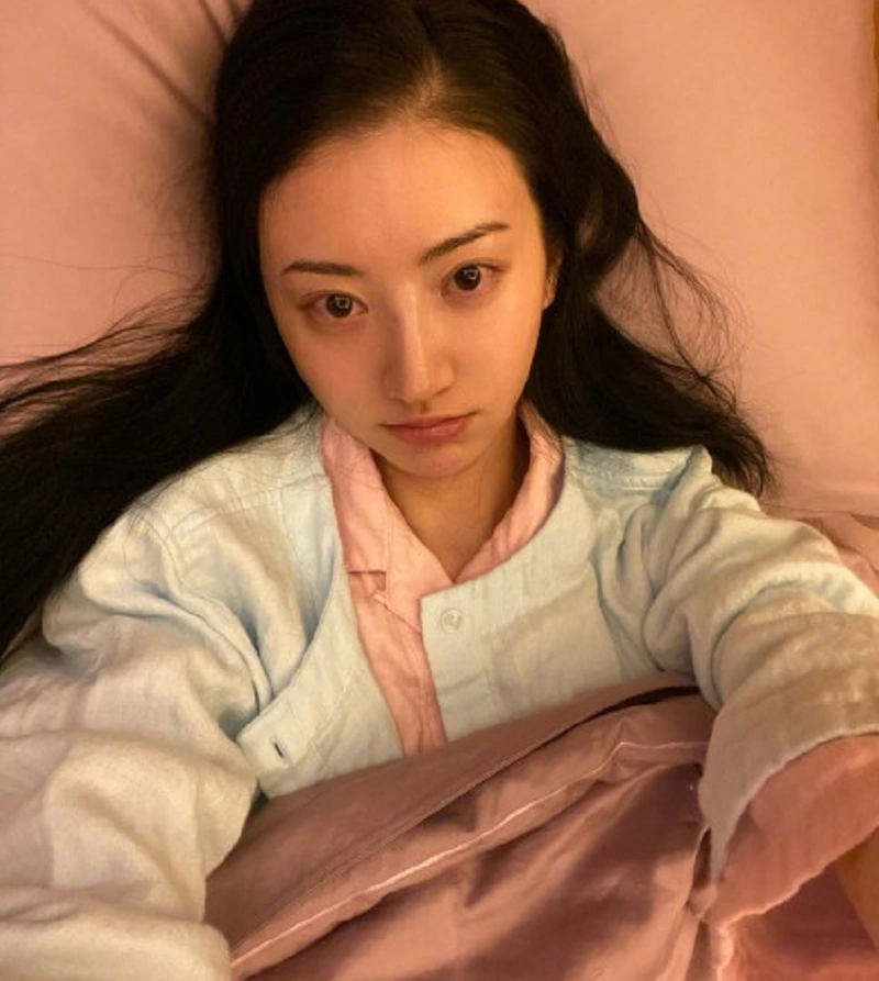 景甜发烧生理期拍戏病倒素颜自拍两眼通红惹人心疼满脸疲态