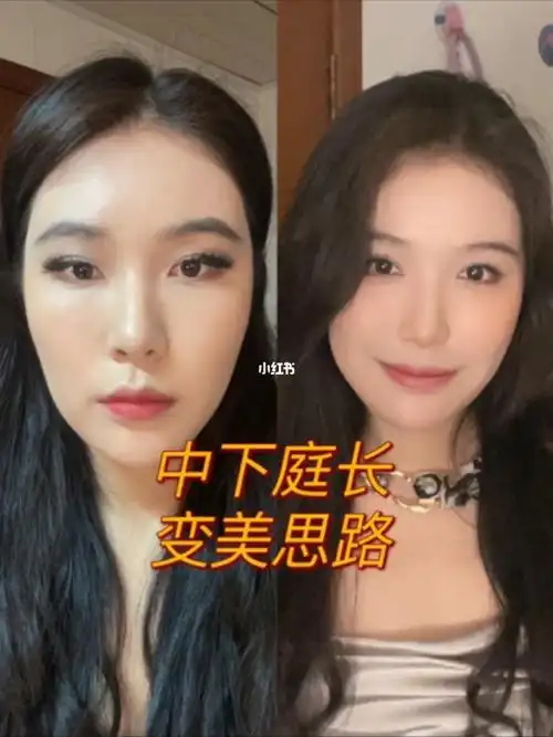 告别马脸变美变年轻中下庭长的92