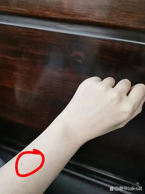 听说美女子手臂的这个位置都有痣 那我就是双倍美女(bushi)