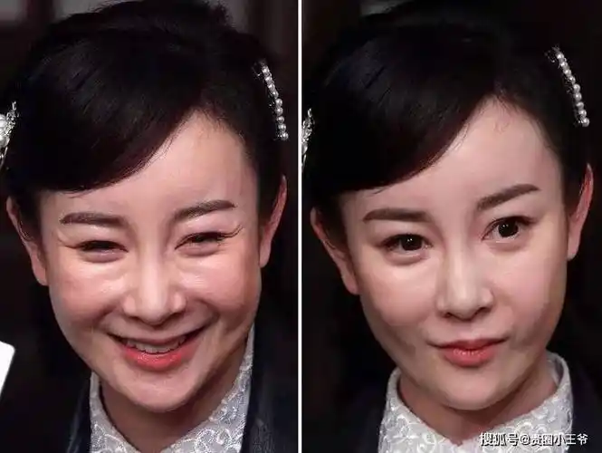 沉迷整容的4位女明星,有人"逆天改命"爆红,有人断送大好前程