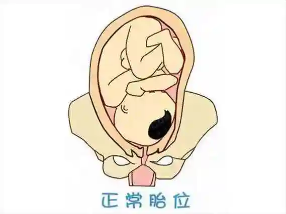 朋友说胎儿头位容易看男女,具体怎么看?