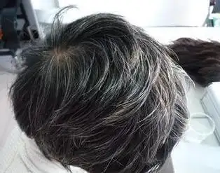 吃什么能把头发变黑吗 - 鞍知识