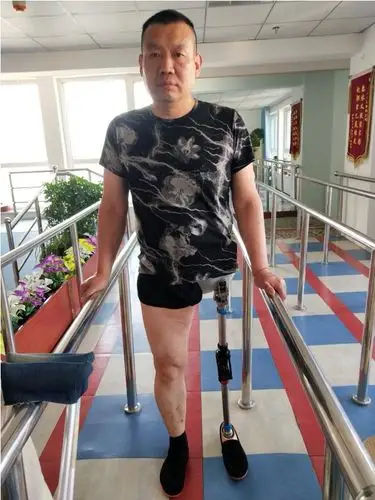 丛台区残联组织开展假肢装配工作