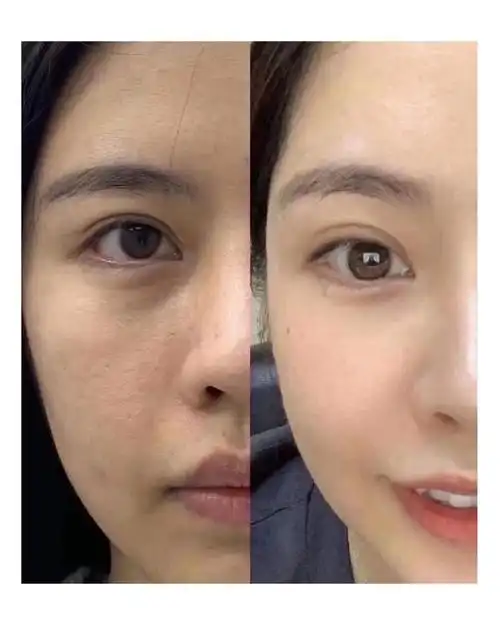 皮肤衰老的机制及防治研究进展_皮肤松弛_皮肤松弛介绍 - 好大夫在线