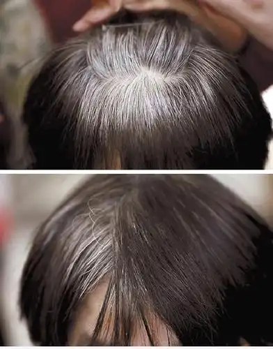 白发变黑,土豆片的这些妙用今天才知道!