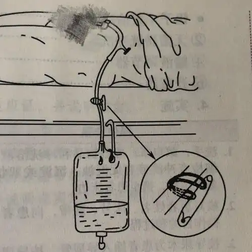 导尿管床边护理示意图