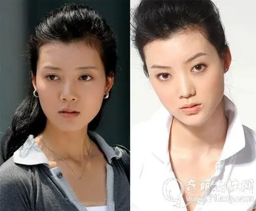 车晓整容前后对比照片 车晓变脸笑容僵硬