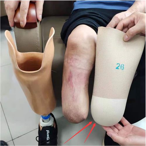 假肢大腿 假肢套 硅胶套凝胶套 大腿套 小腿套  非alps 阿尔卑斯 20