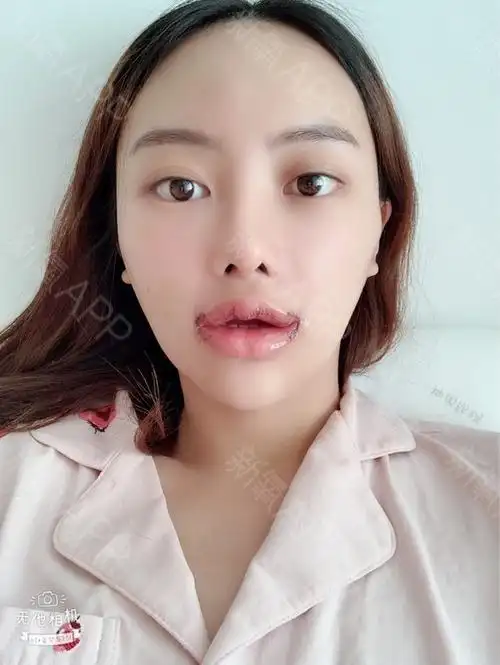 嘴巴是可以张开的哦～可以吃包子,粥,排骨汤～完全不用挨饿的