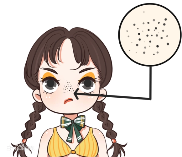 黑头到底怎么解决一文带你读懂黑头问题