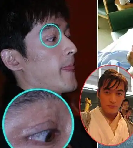 【图】胡歌眼角疤痕仍在 受伤九年后成功蜕变