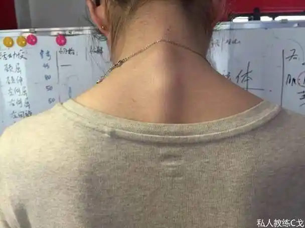 这个部位凸起可不仅是颈椎病_手机搜狐网