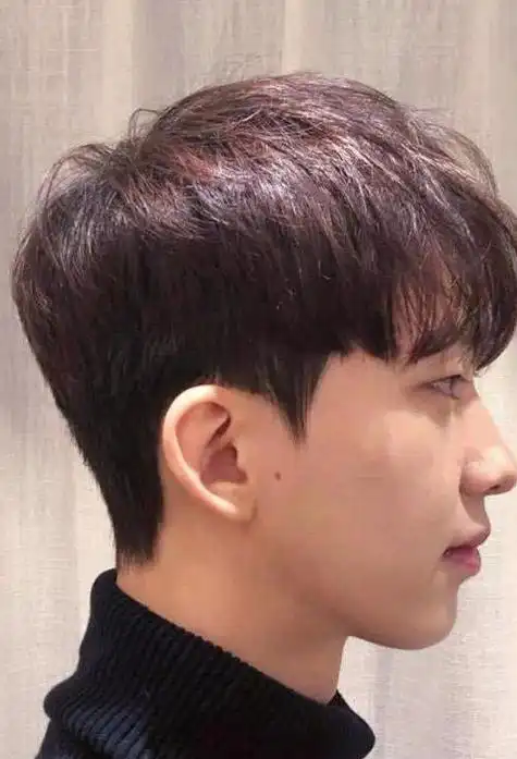 男生头发稀少适合什么发型