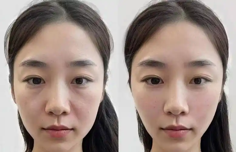 这几款开启抗皱新赛道!_肌肤_效果_皮肤