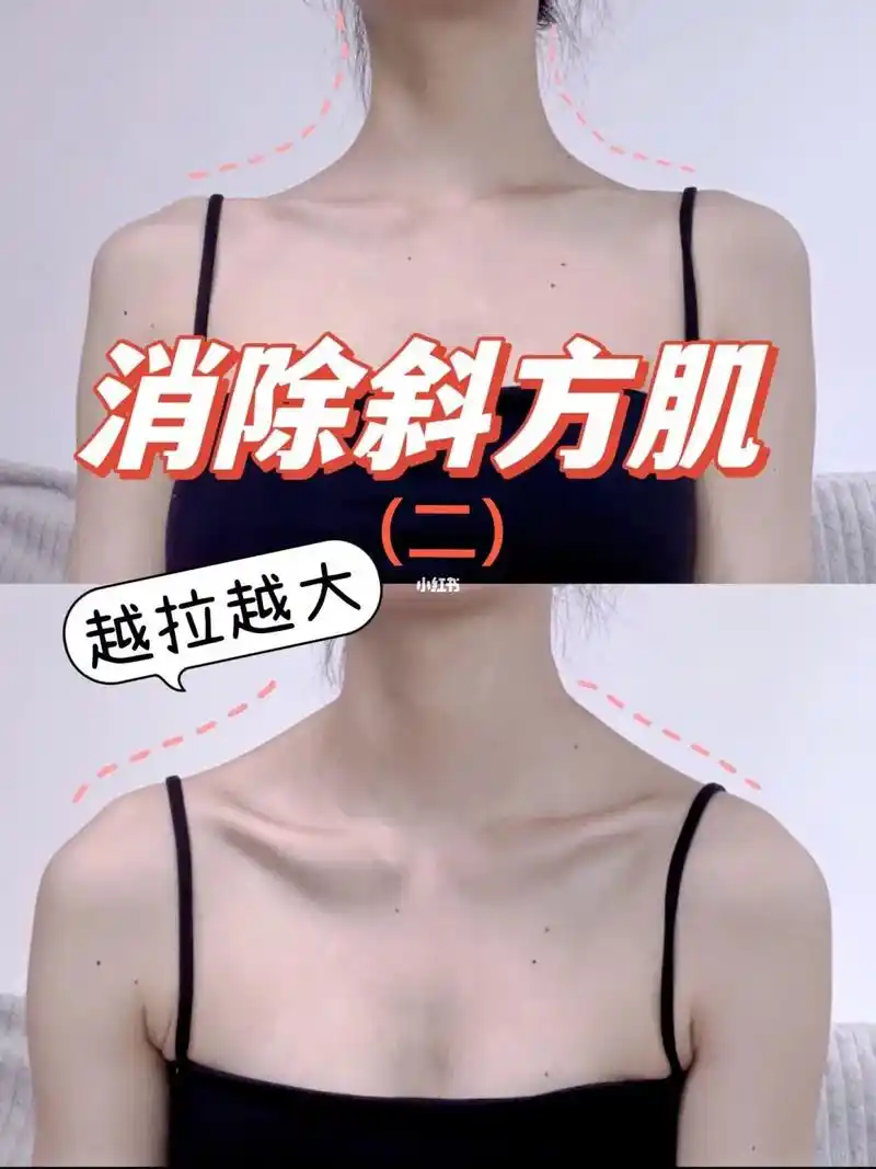 消除斜方肌(二)消除斜方肌(二) 斜方肌过高过大的原因之二: - 抖音