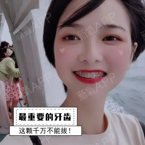 虎牙作为人人都有_圈子-新氧美容整形