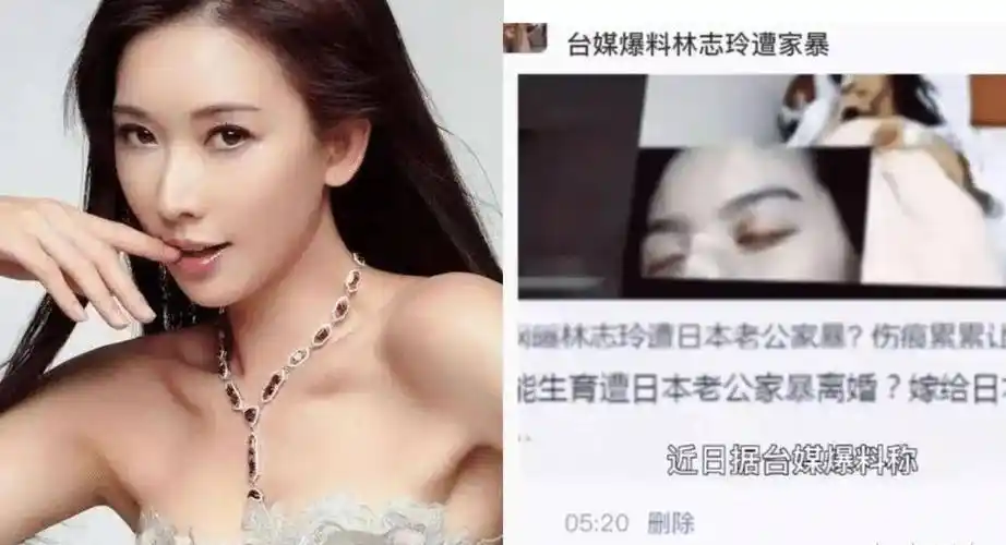 大瓜,林志玲家暴风波升级,男方属于惯犯,疑因孩子不像爸爸?
