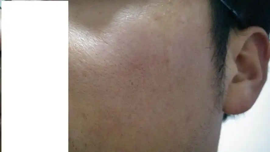 脸上的皮肤出问题了 请帮忙诊断下