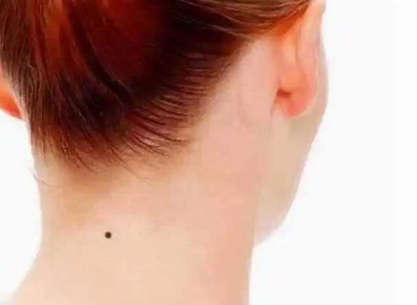 后脖子有痣,表示有靠山,做工作,经商都能有贵人相助.