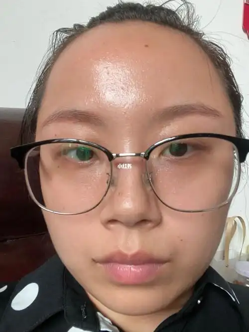 谁能救救我的大油田油皮实在太苦恼了