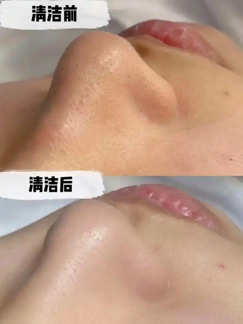 米娜护肤造型面部清洁38