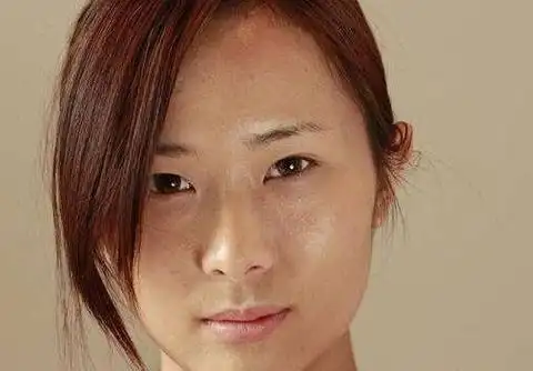 皮肤过黄该怎么办?