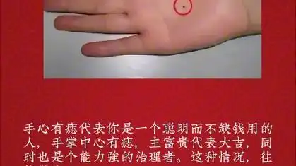 掌心有痣运势如何